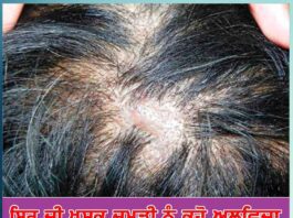 say-goodbye-to-dry-head-skin