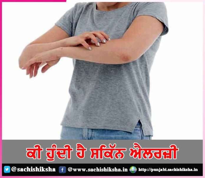 why do skin allergies happen -sachi shiksha punjabi