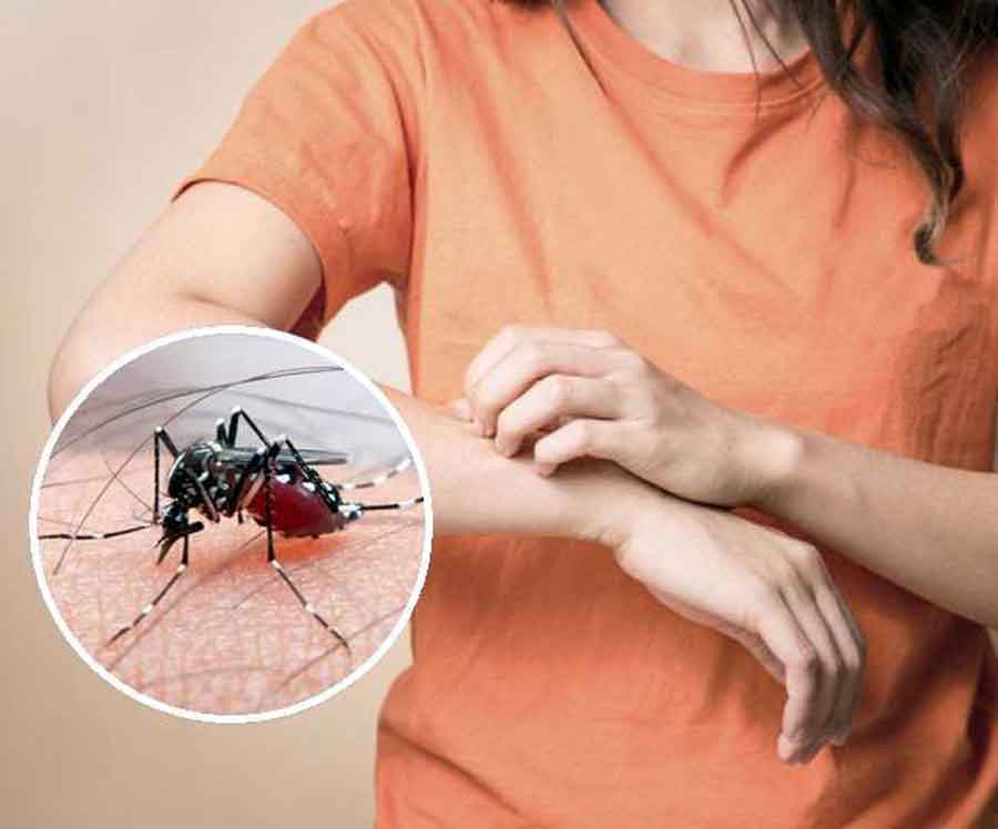 Dengue fever,Dengue mosquito,dengue mosquito bite