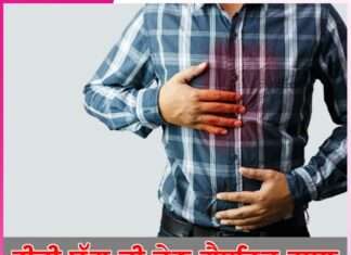 Gastric Problem