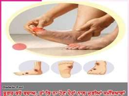 Diabetes Foot