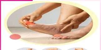 Diabetes Foot: ਸ਼ੂਗਰ ਕਰੋ ਬਚਾਅ, ਤਾਂ ਕਿ ਨਾ ਹੋਣ ਪੈਰਾਂ ਨਾਲ ਜੁੜੀਆਂ ਸਮੱਸਿਆਵਾਂ Diabetes Foot