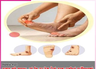 Diabetes Foot: ਸ਼ੂਗਰ ਕਰੋ ਬਚਾਅ, ਤਾਂ ਕਿ ਨਾ ਹੋਣ ਪੈਰਾਂ ਨਾਲ ਜੁੜੀਆਂ ਸਮੱਸਿਆਵਾਂ Diabetes Foot