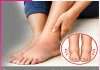 Swelling feet: ਪੈਰਾਂ ਦੀ ਸੋਜ ਤੋਂਆਰਾਮ ਦੇਣਗੇ ਕੁਦਰਤੀ ਤਰੀਕੇ Swelling feet