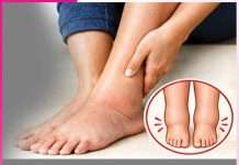 Swelling feet: ਪੈਰਾਂ ਦੀ ਸੋਜ ਤੋਂਆਰਾਮ ਦੇਣਗੇ ਕੁਦਰਤੀ ਤਰੀਕੇ Swelling feet