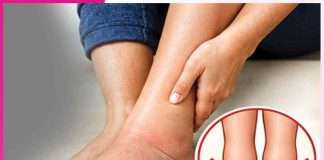 Swelling feet: ਪੈਰਾਂ ਦੀ ਸੋਜ ਤੋਂਆਰਾਮ ਦੇਣਗੇ ਕੁਦਰਤੀ ਤਰੀਕੇ Swelling feet