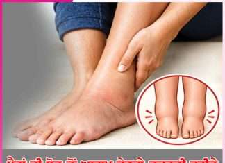Swelling feet: ਪੈਰਾਂ ਦੀ ਸੋਜ ਤੋਂਆਰਾਮ ਦੇਣਗੇ ਕੁਦਰਤੀ ਤਰੀਕੇ Swelling feet