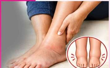 Swelling feet: ਪੈਰਾਂ ਦੀ ਸੋਜ ਤੋਂਆਰਾਮ ਦੇਣਗੇ ਕੁਦਰਤੀ ਤਰੀਕੇ Swelling feet