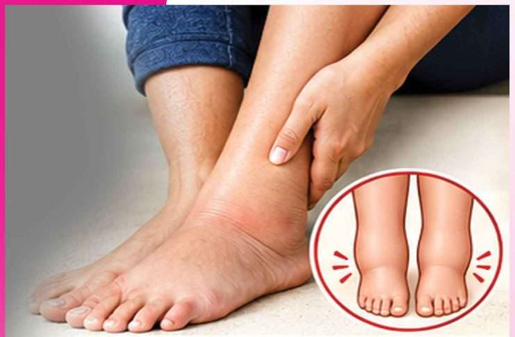 Swelling feet: ਪੈਰਾਂ ਦੀ ਸੋਜ ਤੋਂਆਰਾਮ ਦੇਣਗੇ ਕੁਦਰਤੀ ਤਰੀਕੇ Swelling feet