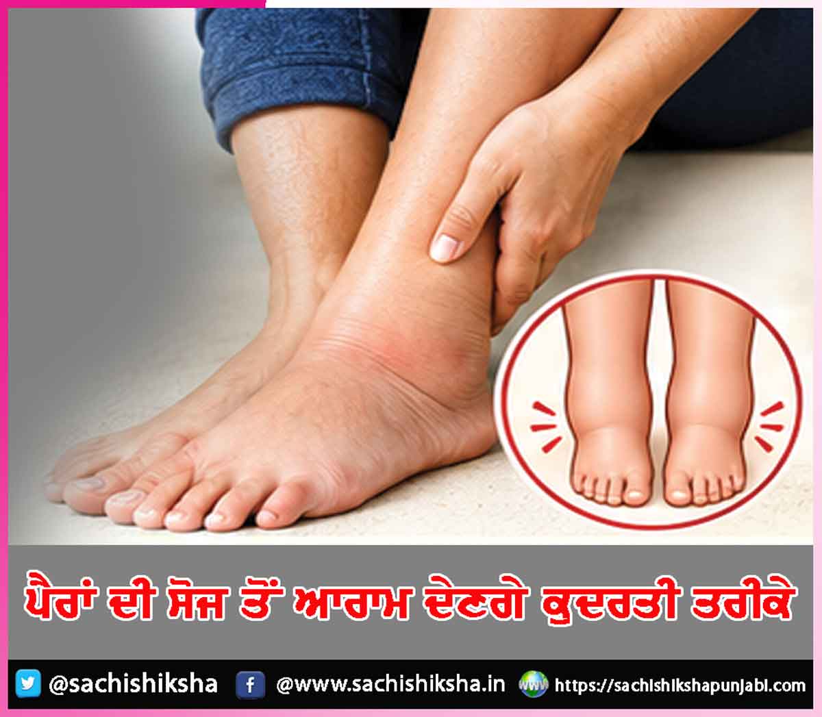 Swelling feet Swelling feet
